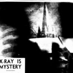 X-RAY MYSTERY AT  LITHGOW
